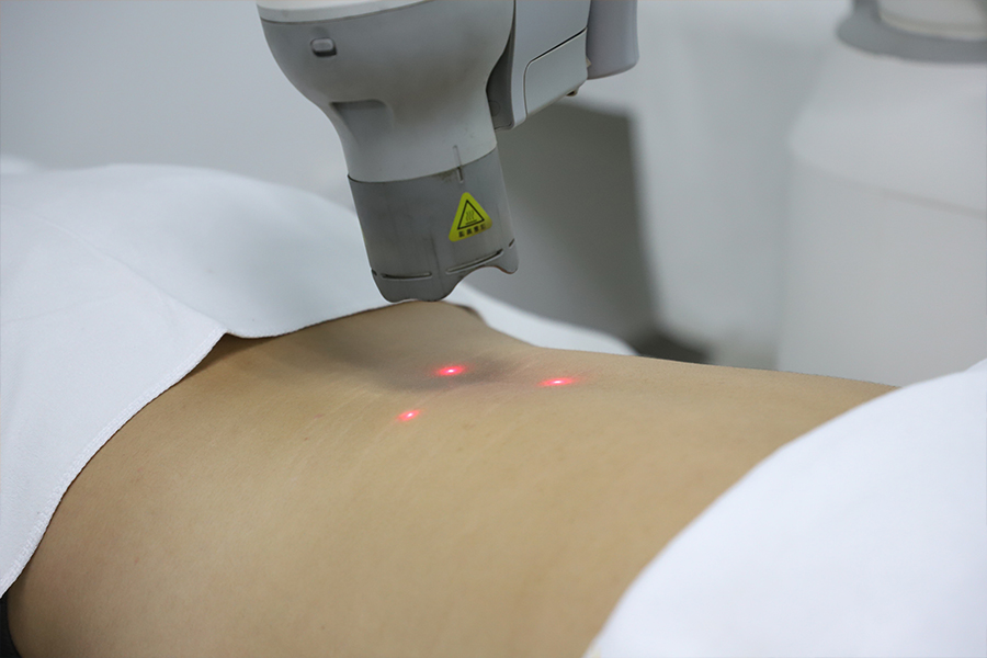 智能艾灸：提升傳統(tǒng)艾灸館服務(wù)效率