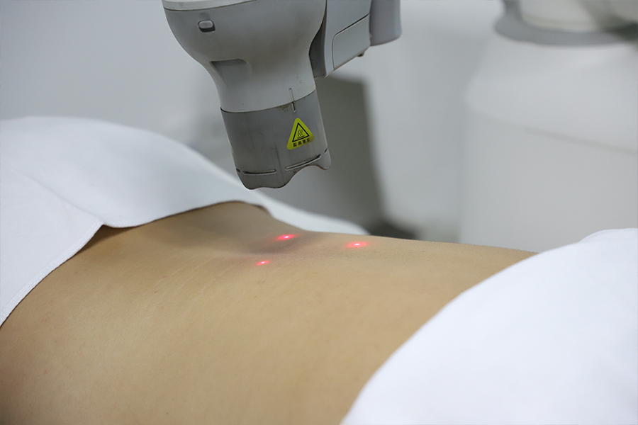 智能艾灸-個(gè)性化診療