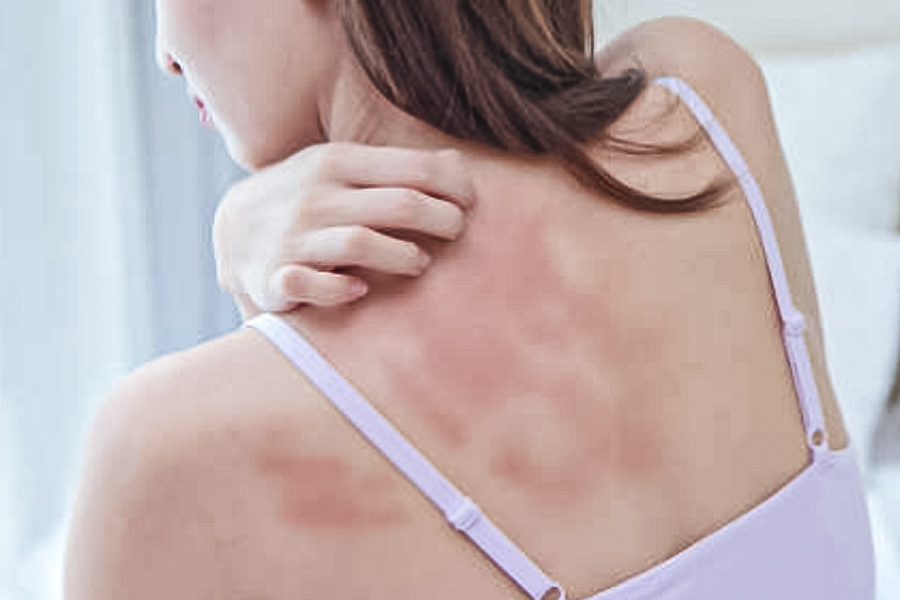 皮膚敏感人群能用智能艾灸機(jī)器人嗎？低敏模式與接觸材質(zhì)選擇建議