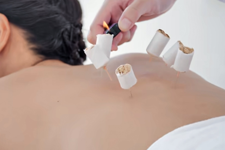 動(dòng)態(tài)手法專利突破！智美康民艾灸機(jī)器人高精度機(jī)械臂還原5大灸法